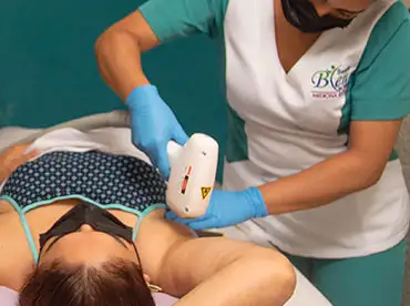  depilacion laser managua