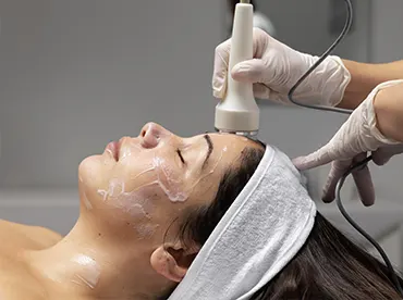 qué_es_radiofrecuencia_facial